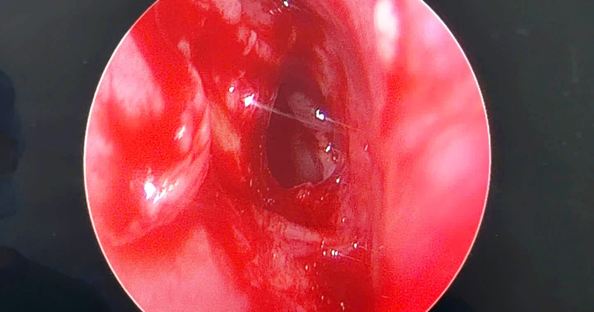 1 1768036389366522008591 94 0 994 1440 Crop 17680364833321984680261