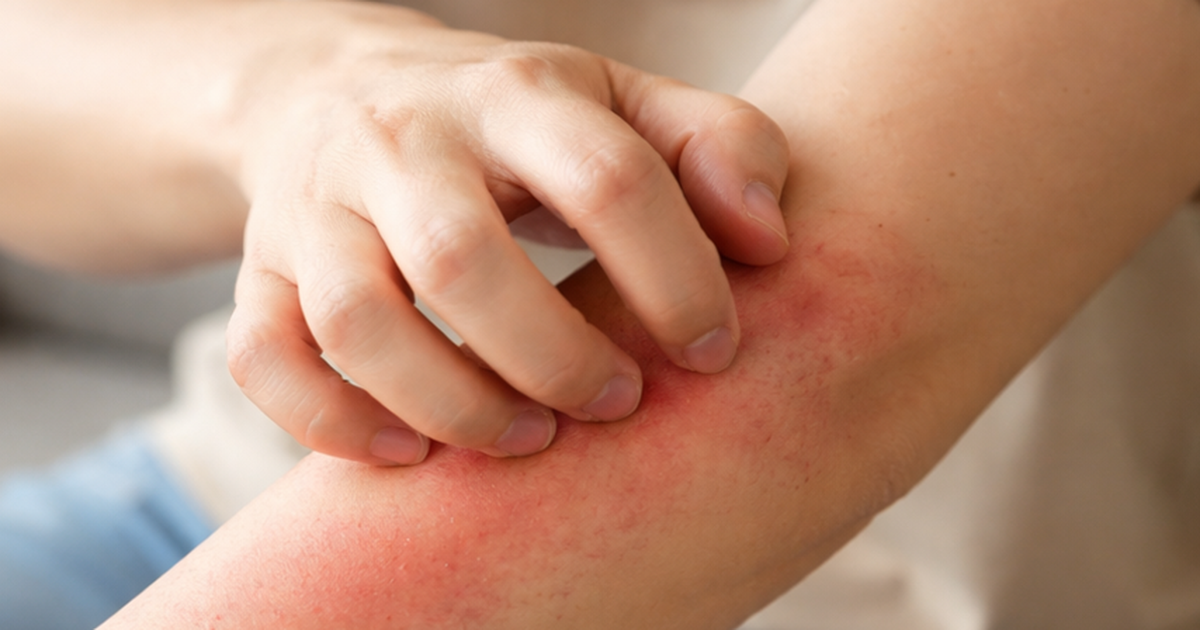 1 Ngua Da 1768396256446202389979 156 170 690 1024 Crop 17683962815401690835126