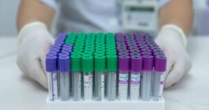 Từ 2027 Quỹ Bhyt Sẽ Chi Trả Sàng Lọc Sớm Một Số Bệnh 13B 1768302800804334603962 0 0 1600 2560 Crop 17683028283421527254938