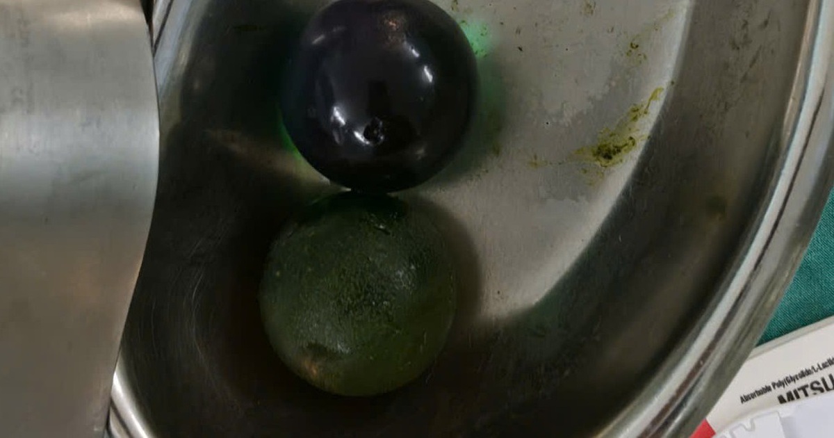 1Hat No 1769858052901624105913 36 0 682 1034 Crop 17698580657741333591623