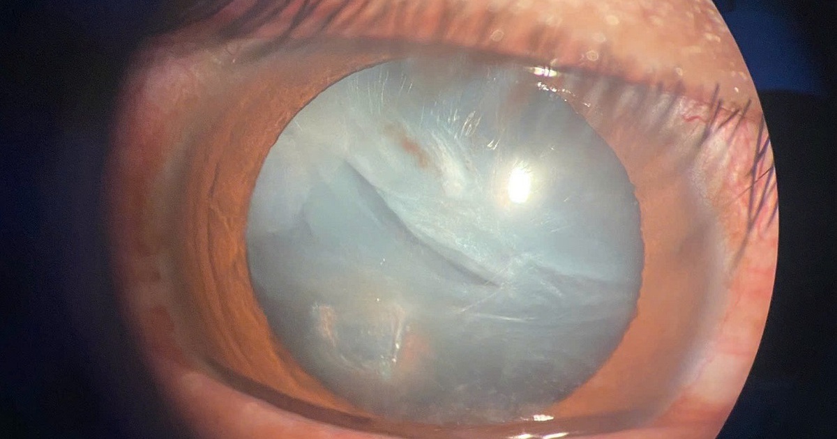 1Mat 1767171075475836461232 163 0 900 1179 Crop 1767171171503158481832