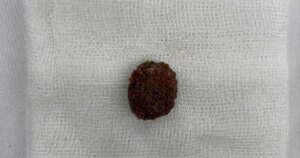 2soi than 17751957745371016166513 44 0 544 800 crop 17751958023191920036817