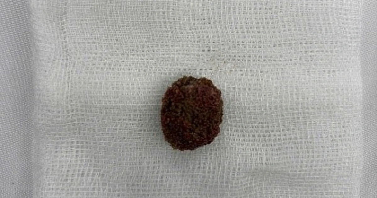 2soi than 17751957745371016166513 44 0 544 800 crop 17751958023191920036817