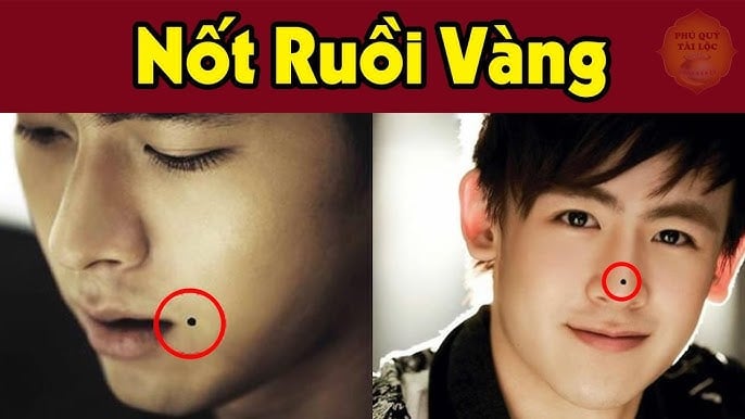 3 not ruoi may man ai co duoc dung dai xoa di 094628