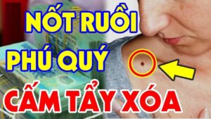 3 not ruoi may man dai phu dai quy ai co duoc dung dai xoa di 083636