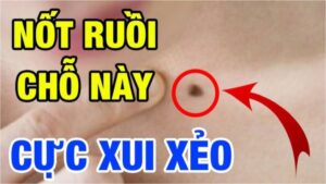 3 not ruoi xui xeo can tro tai loc nen tim cach hoa giai keo ca doi khong ngoc dau len duoc 112748.j