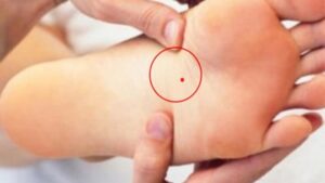 4 Nốt Ruồi Ở Chỗ Kín Hút Tài Lộc: Đừng Dại Xóa Đi 4 Not Ruoi O Cho Kin Hut Tai Loc Dung Dai Xoa Di 092046