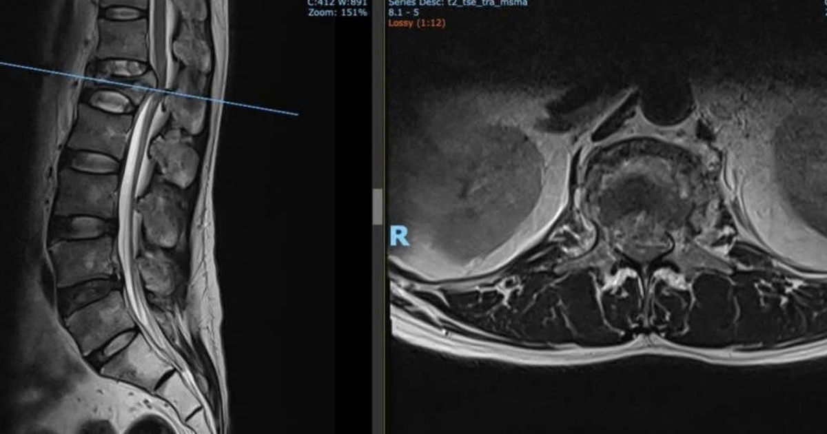 480fc8d113d5928bcbc4 1777456553975340330593 0 165 640 1189 crop 17774567876952035362687