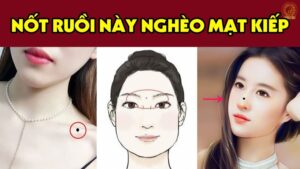 5 not ruoi ca tro tai loc nen tim cach hoa giai 092351