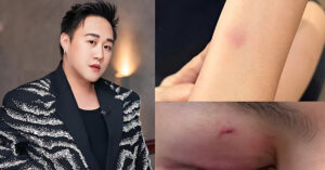 5 vu sao viet danh nguoi nguoi thua nhan say ruou ke bi tat giua phim truong 3181