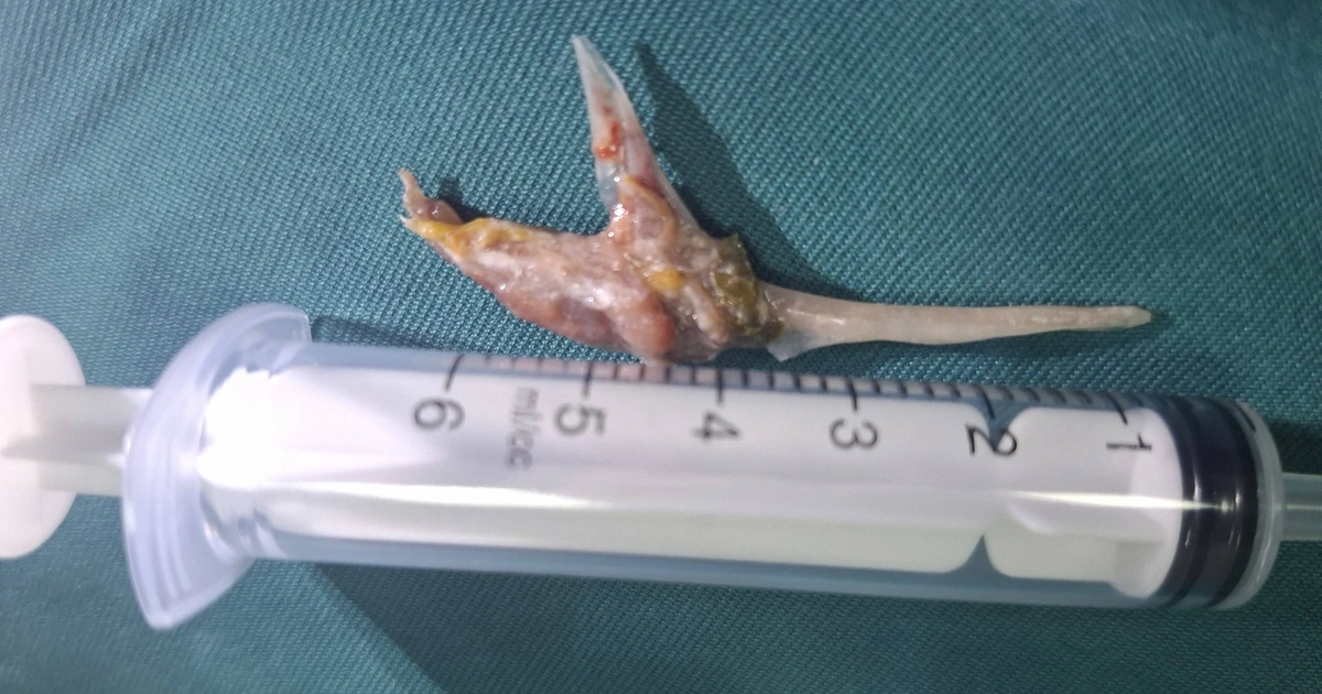 62413616837460013922326515546966773021471788n 1776734369469932427386 170 0 1242 2048 crop 1776734474