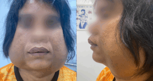 A X Song Cung 2 Khoi U Khong Lo Vung Mat Suot 10 Nam 17604988259051675582504 62 0 1402 2560 Crop 176