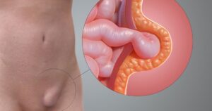 A1 17665609007371661585962 231 0 964 1400 Crop 176656116152847025989