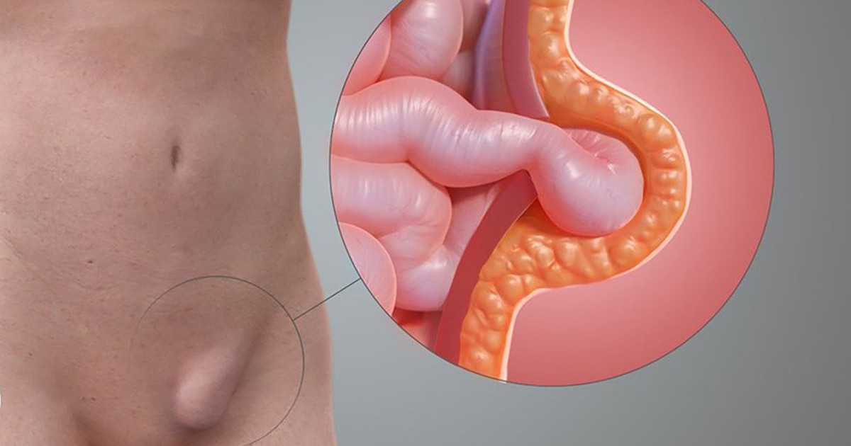 A1 17665609007371661585962 231 0 964 1400 Crop 176656116152847025989