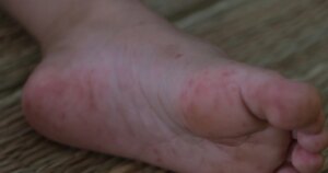 anh 2 1775130535686414958651 0 0 1600 2560 crop 1775130674209688403865