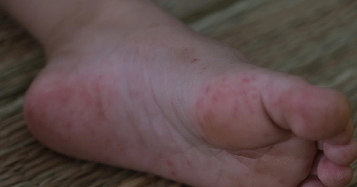 anh 2 1775130535686414958651 0 0 1600 2560 crop 1775130674209688403865