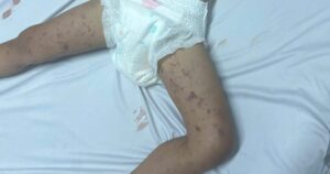 anh viem nao mo cau 1777337662851283058311 0 0 600 960 crop 17773376997131967915493