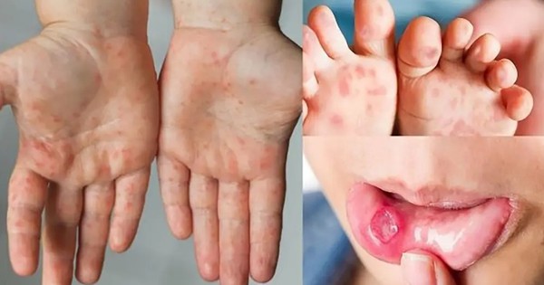 Avatar1762149746879 176214974742414501541