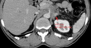 Avatar1766561824120 1766561825190475455914 297 0 831 1019 Crop 17665618848051894501255