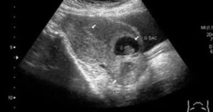 Avatar1766741770994 1766741771397454008092