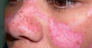 Avatar1768484347197 1768484347613120875148