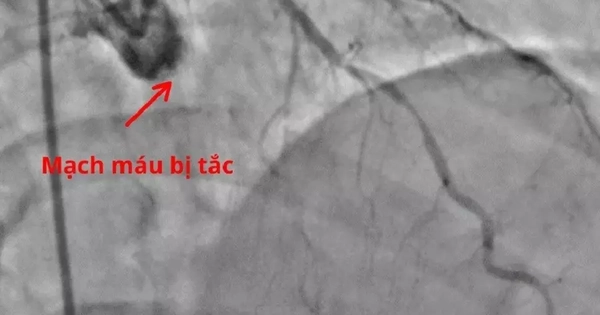 Avatar1768973520138 1768973520566160064481.Webp