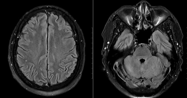 Avatar1769746668871 1769746672853698468323 0 0 459 877 Crop 17697468464091224848426