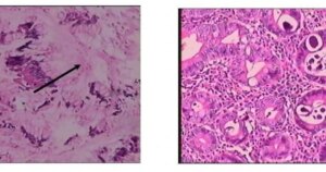 avatar1771826466102 17718264665141618621517