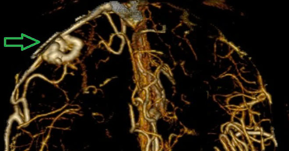 avatar1774235003052 1774235003912379704420 36 0 381 659 crop 17742351183641234184491