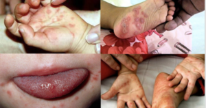 avatar1774579963738 1774579966385256639129