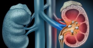 avatar1774604014015 1774604014374351039843 32 0 346 600 crop 17746040679701989724846