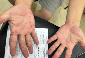 avatar1774747369888 17747473712191183459510