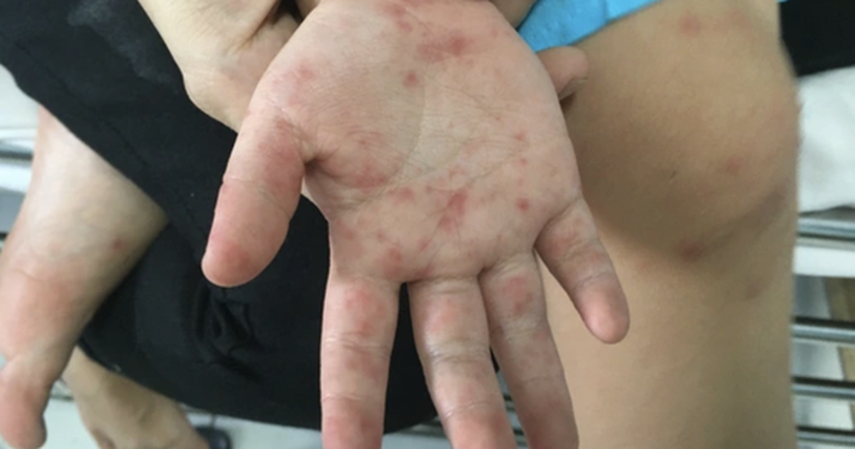 avatar1775309231232 1775309231562212634441