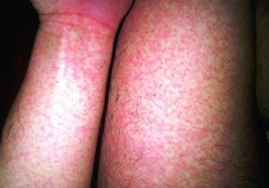 avatar1776931882515 17769318828081034455404