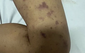 avatar1777331486065 1777331486479795145316.webp