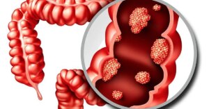 avatar1777364101043 1777364102224200288403 122 0 658 1024 crop 17773642198631935594814