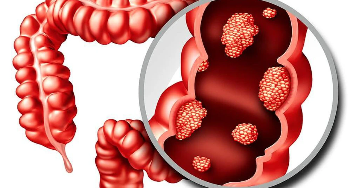 avatar1777364101043 1777364102224200288403 122 0 658 1024 crop 17773642198631935594814