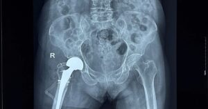 Base64 1767147840453840587963 115 0 1365 2000 Crop 1767147891579202331823