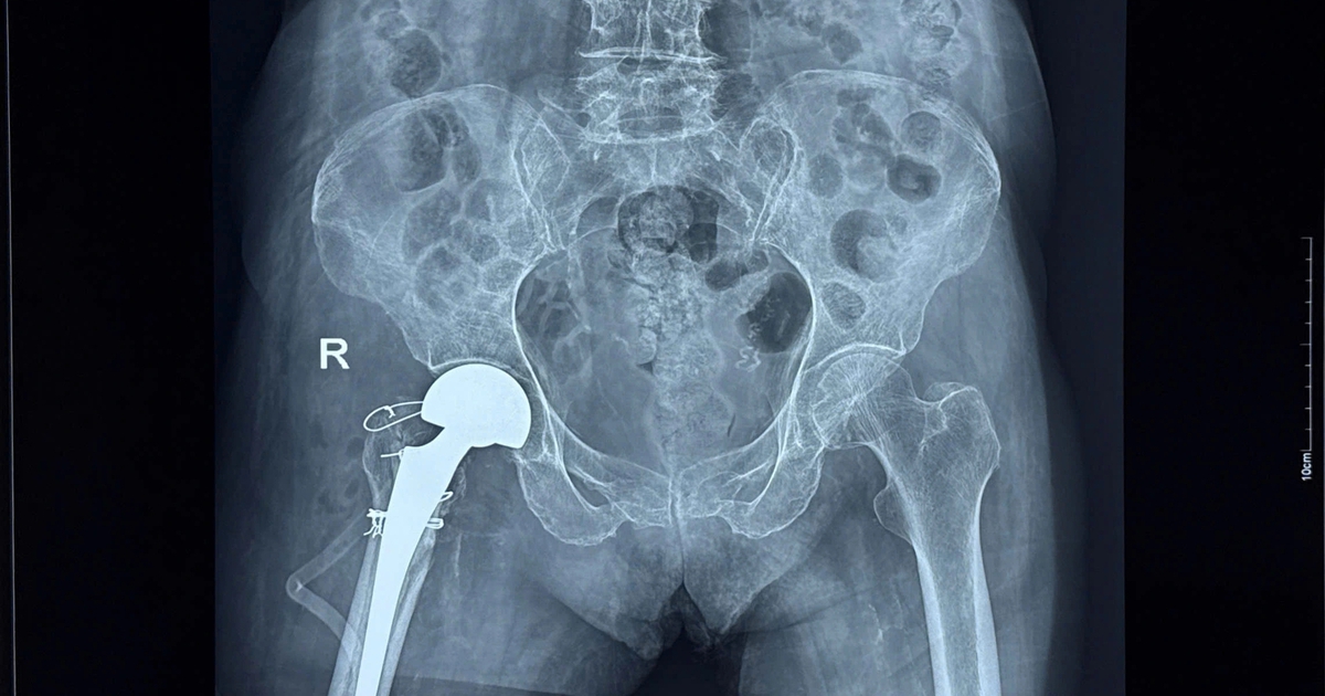 Base64 1767147840453840587963 115 0 1365 2000 Crop 1767147891579202331823