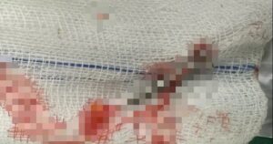 Base64 17689018969511796186466 91 0 485 631 Crop 1768902010226808148225