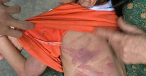 be gai lop 2 bi ban dung thuoc danh bam tim nguoi 1059