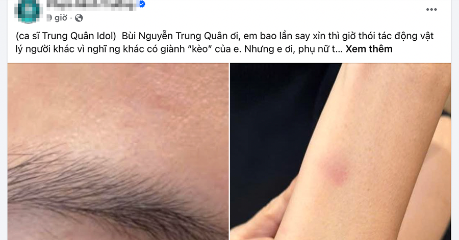 cong an xac minh thong tin trung quan idol bi to hanh hung nu bac si 2239