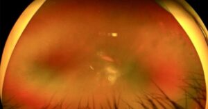 Dai Thao Duong 1761648681907405033640 0 0 528 845 Crop 1761648684786210077278