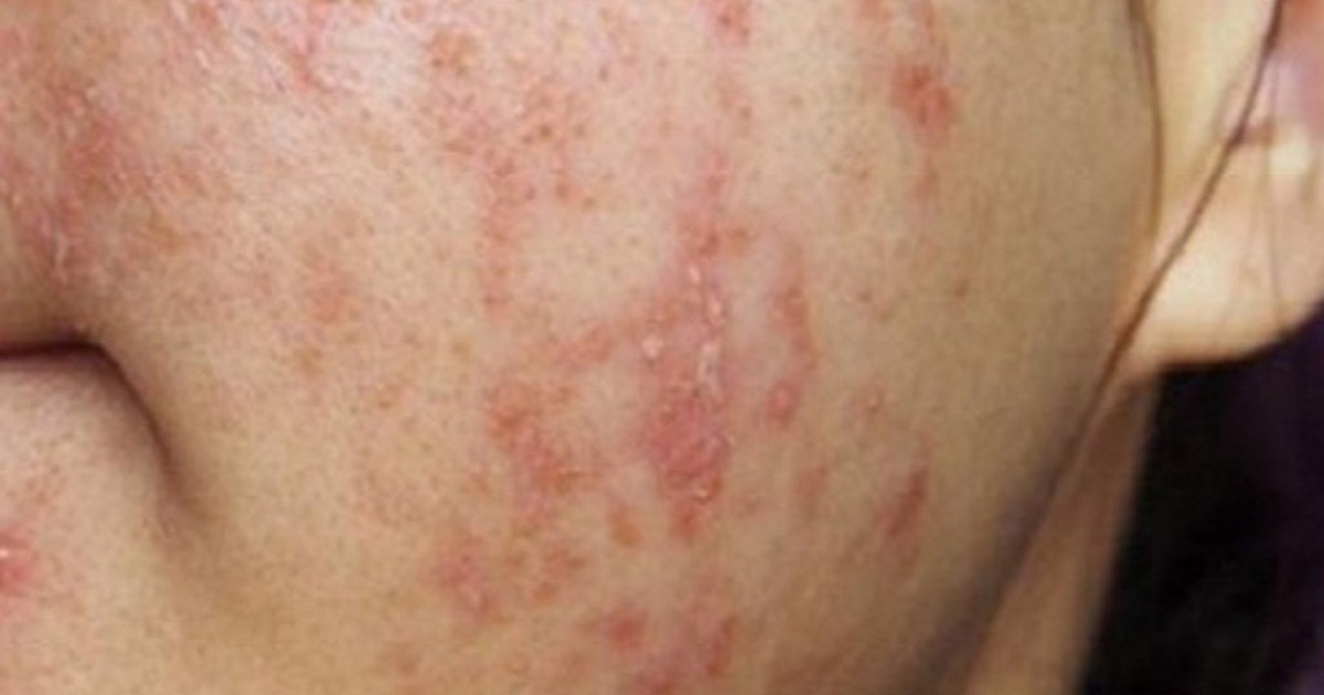 Danhiemcorticoidmm 1770368032463357130473 65 0 705 1024 Crop 17703680782731594232019