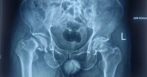 Dau Khop Hang 2 17731361887231891690768 0 12 758 1225 Crop 17731367803521565384579