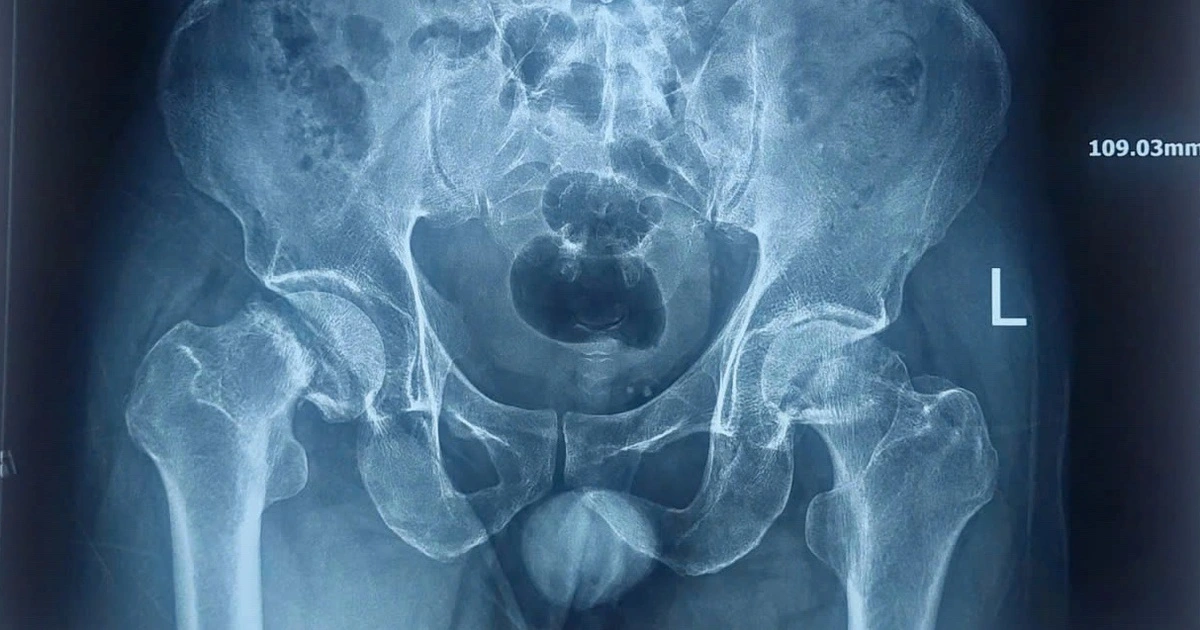 Dau Khop Hang 2 17731361887231891690768 0 12 758 1225 Crop 17731367803521565384579