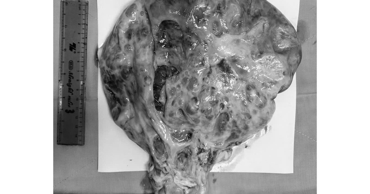 Dd911C6611459E1Bc754 176647363327669690663 39 0 882 1348 Crop 1766473641806562757045