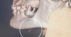 Di Vat 1 17705357029221824520740 114 0 633 831 Crop 1770535713911178674407