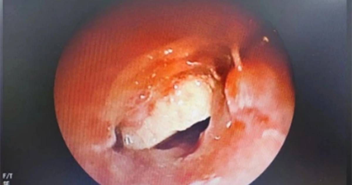 Di Vat 17732200116281988571208 93 0 733 1024 Crop 17732200206881556542885