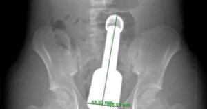 Di Vat Hau Mon 17731437619461406406223 403 0 991 940 Crop 1773143767787517831062